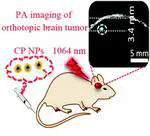 Biocompatible conjugated polymer nanoparticles for highly efficient photoacoustic imaging of orthotopic brain tumors in the second near-infrared window