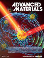 Photoacoustic Imaging: Bright Aggregation-Induced-Emission Dots for Targeted Synergetic NIR-II Fluorescence and NIR-I Photoacoustic Imaging of Orthotopic Brain Tumors